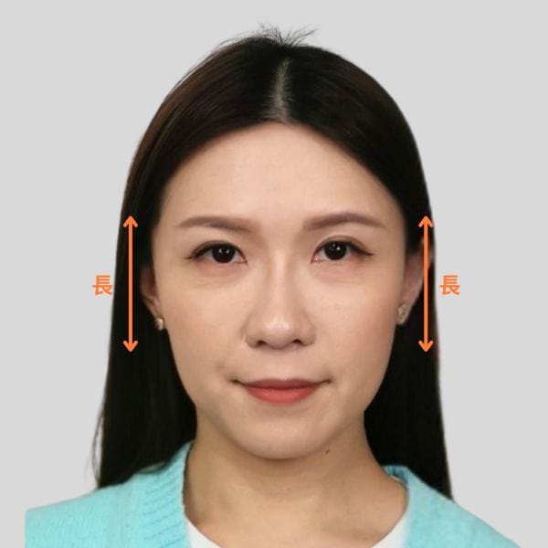 輪廓線條變成順滑鵝蛋面形(前)