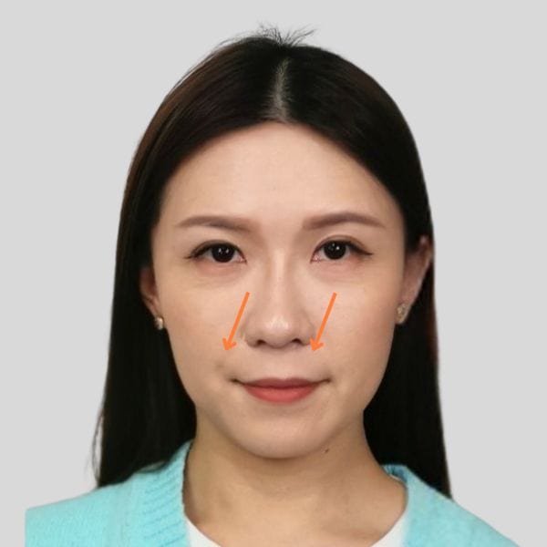 輪廓線條變成順滑鵝蛋面形(前)