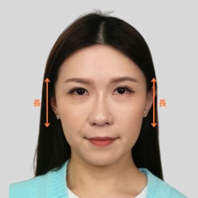 輪廓線條變成順滑鵝蛋面形(前)