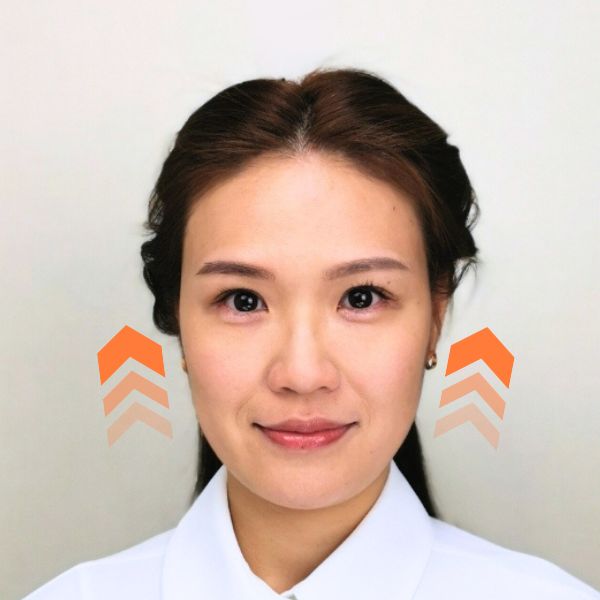 徒手微雕療程後