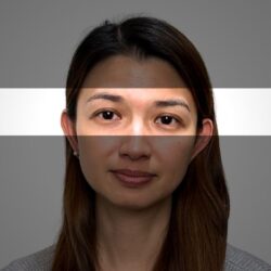 徒手微雕療程前