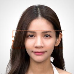徒手微雕療程後