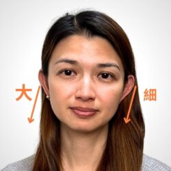 徒手微雕療程前