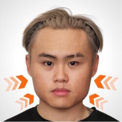 徒手微雕療程後