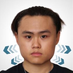 徒手微雕療程前