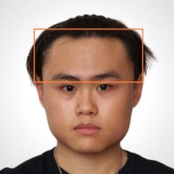 徒手微雕療程前