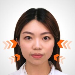 徒手微雕療程後