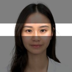 徒手微雕療程後