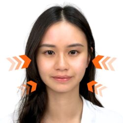 徒手微雕療程後