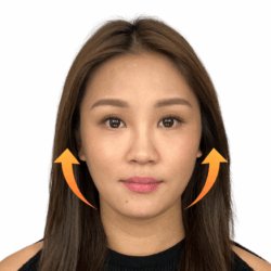 徒手微雕療程後