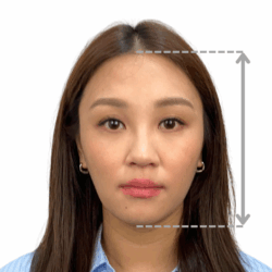 徒手微雕療程前