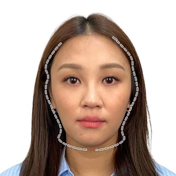 徒手微雕療程前