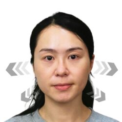 徒手微雕療程前