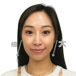 徒手微雕療程前
