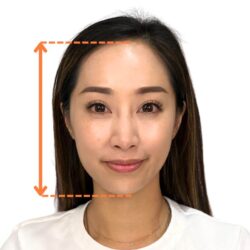 徒手微雕療程後