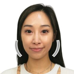 徒手微雕療程前