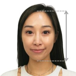 徒手微雕療程前