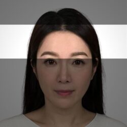 徒手微雕療程後