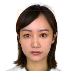 徒手微雕療程後