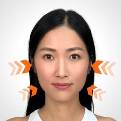 徒手微雕療程後