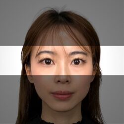 徒手微雕療程後