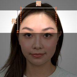 徒手微雕療程後