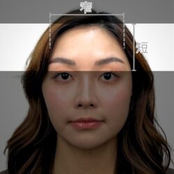 徒手微雕療程前
